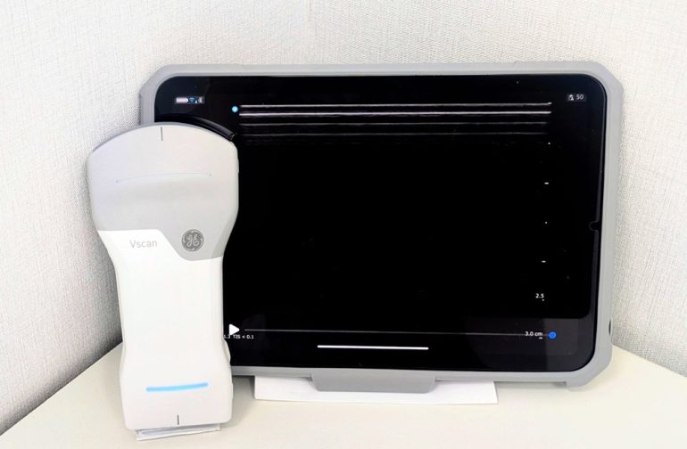 【お知らせ】携帯型超音波診断装置「Vscan Air」を導入しました