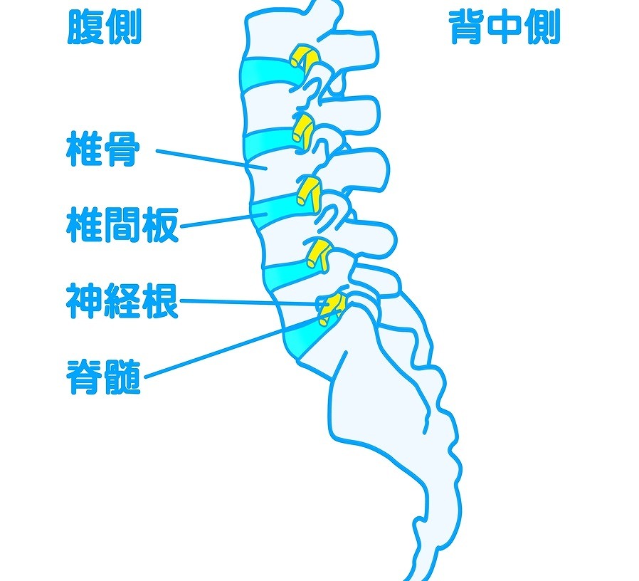 椎間孔狭窄症とは？症状は？