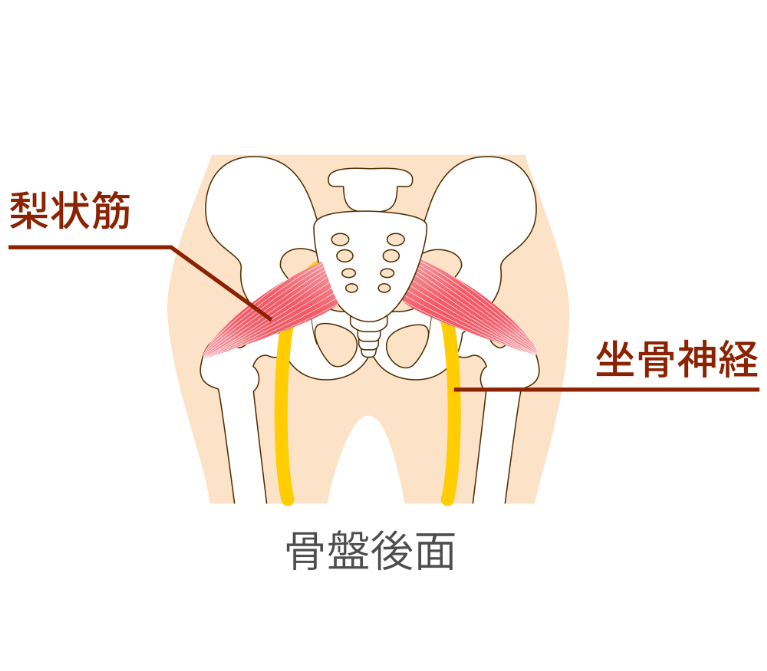坐骨神経痛